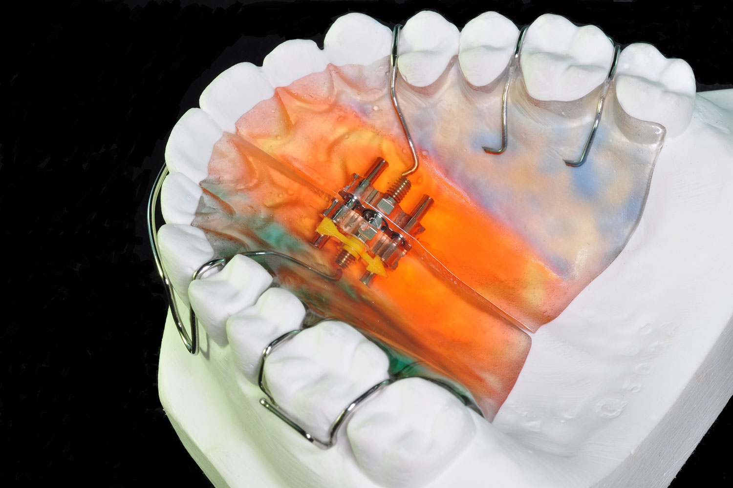 Sharp Dental Laboratory Your Ideal Dental Partner